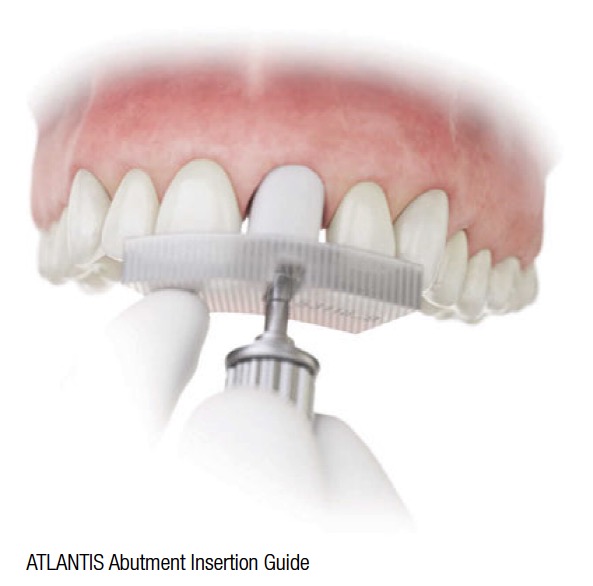 atlantis-abutment-insertion-guide