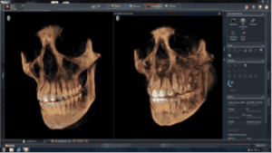 Side-by-side display of multiple images taken over time offers objective anatomical comparisons. 