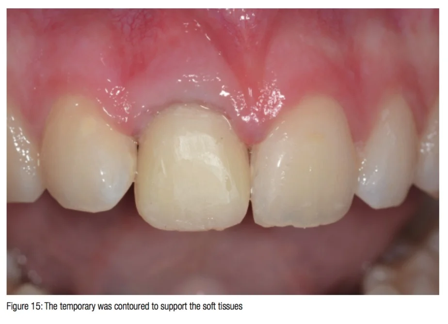 aherne-figure15
