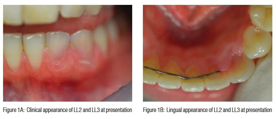 figure1-2-hameed