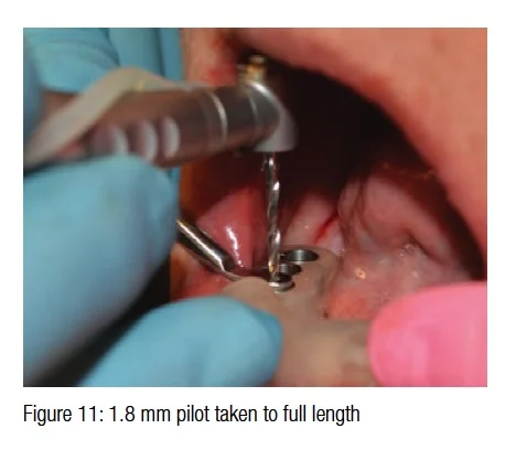 figure11