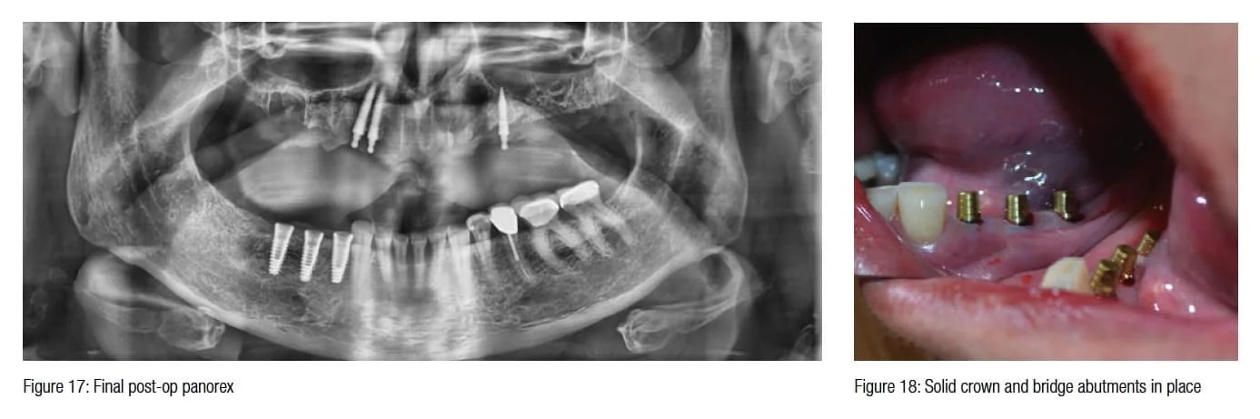figure17-18
