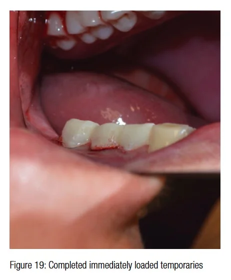 figure19