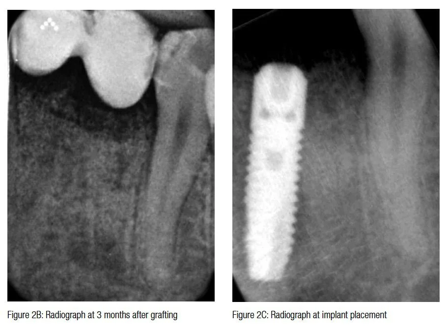 figure2b-2c-hameed