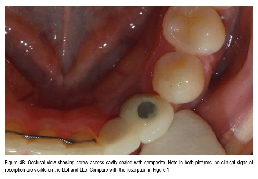 figure4b-hameed
