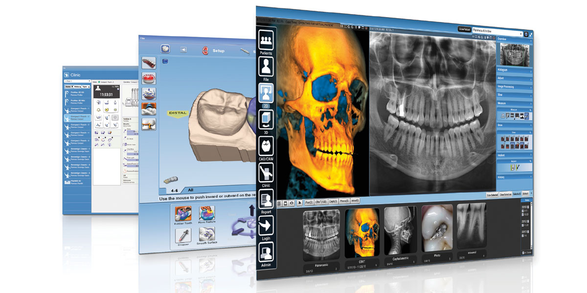 Planmeca Romexis® software Implant Practice US - Dental Publication