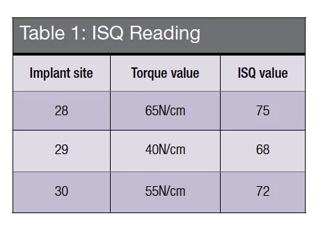 table1-isq-reading