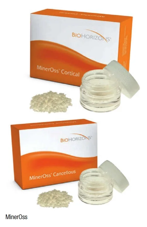 mineross