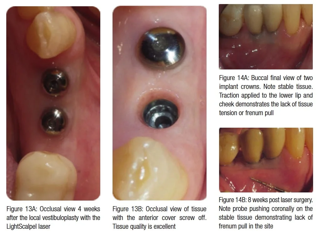figure13a-14b