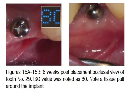 figure15a-15b