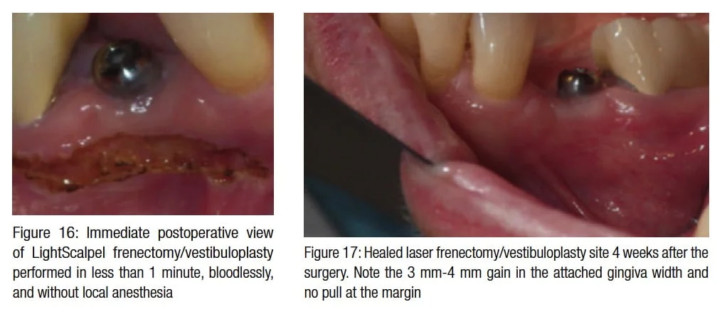 figure16-17