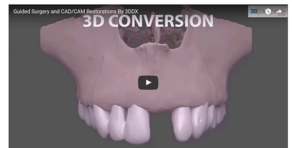 3d_diagnostics_video