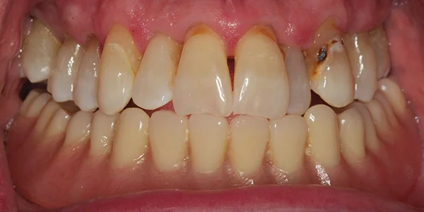 CE_Cooper_600x300