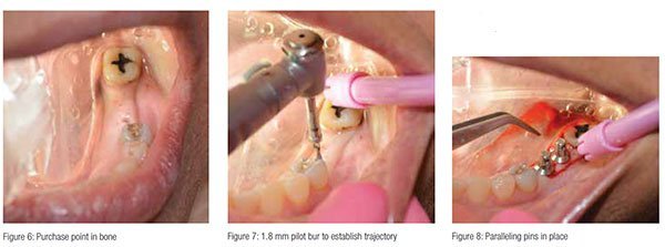 clinical_schlesinger_fig6-8