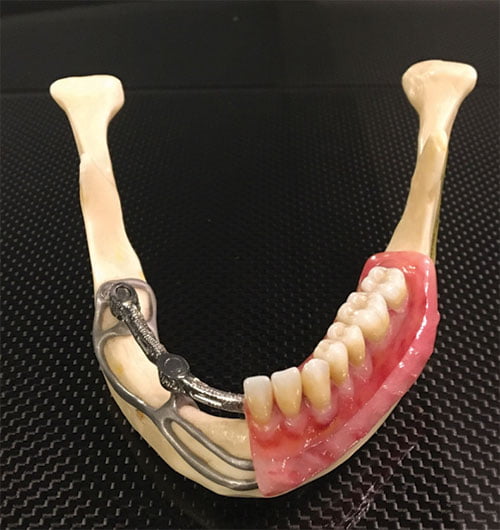 Implant dentistry museum in Venice, Italy, to honor Drs. Leonard I