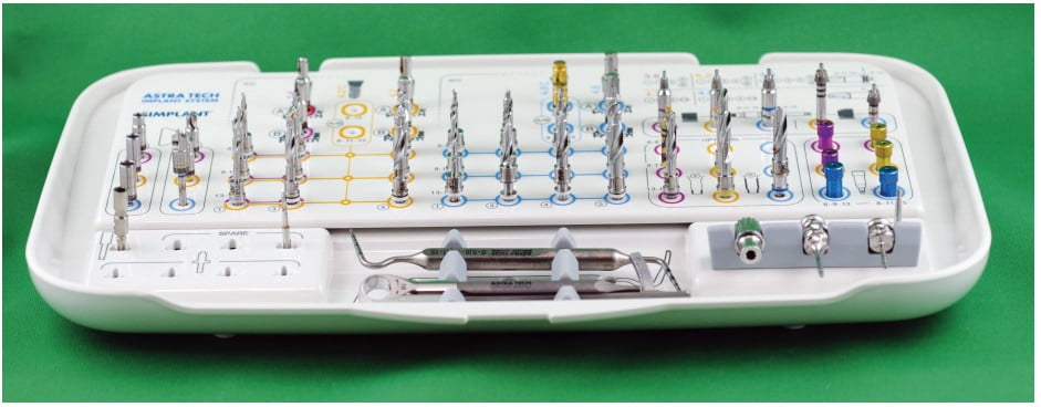 CBCT brings clarity to implant placement