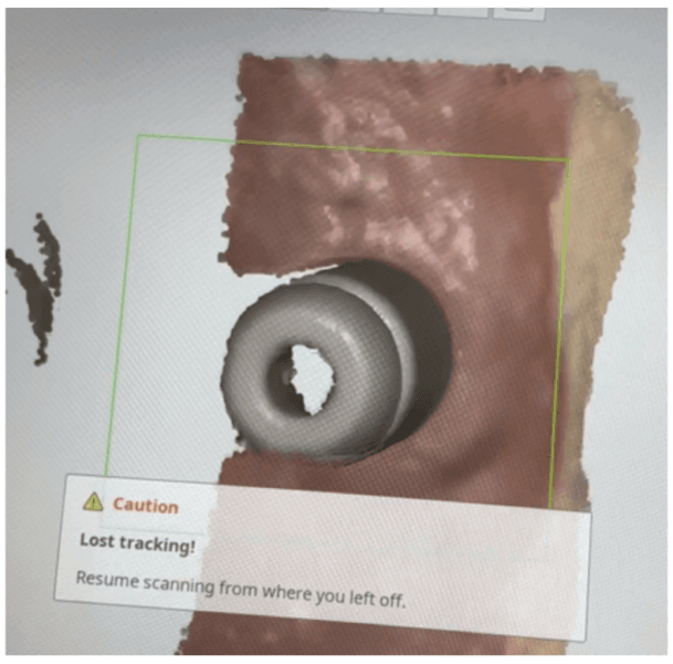 figure 2 most common error involved with full arch digital implant impression