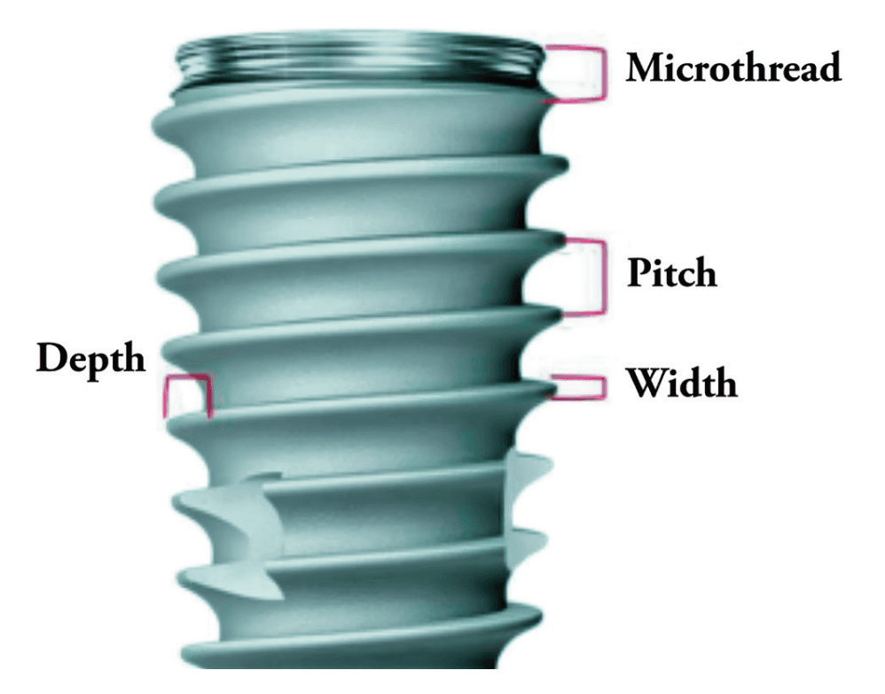 figure 4 implant macro design parameters