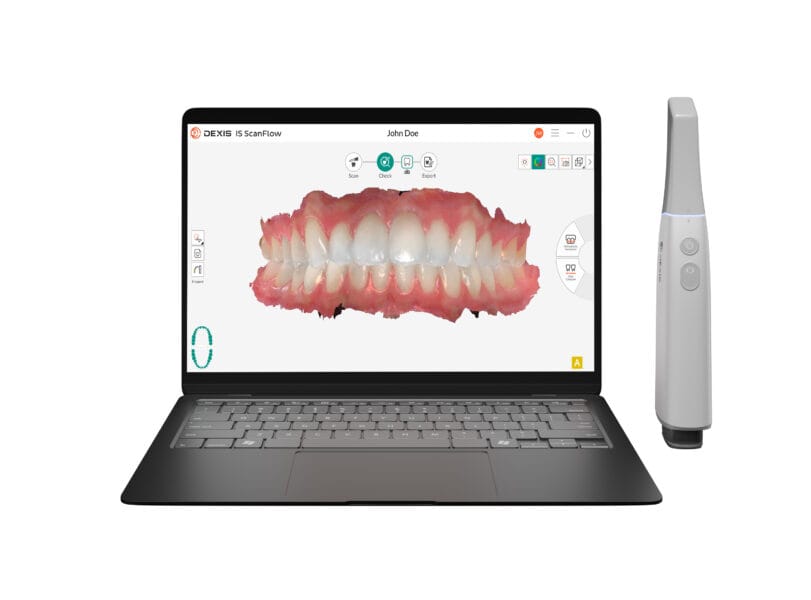 dexis imprevo with is scanflow 2.0 001 (2)