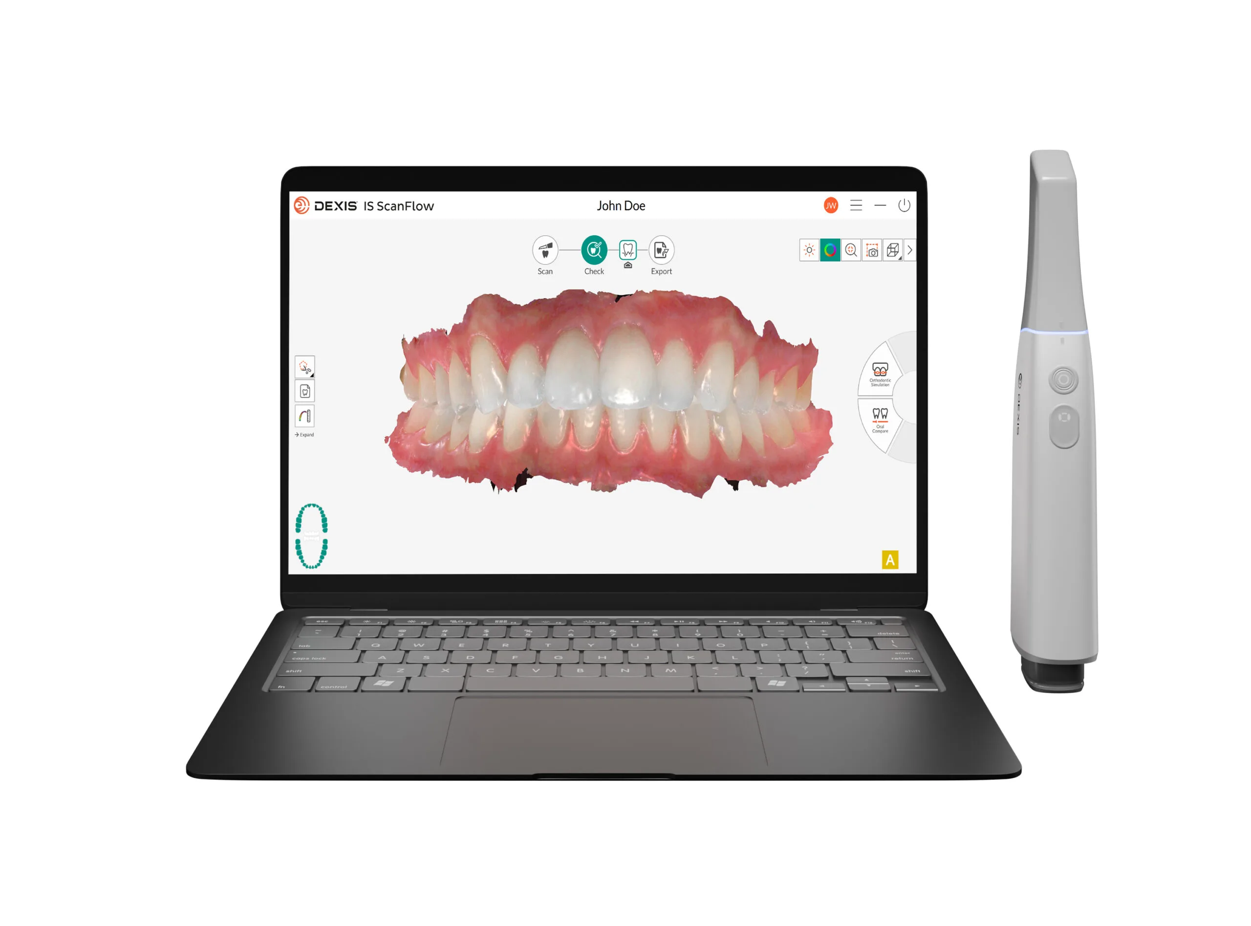 dexis imprevo with is scanflow 2.0 001 (2)