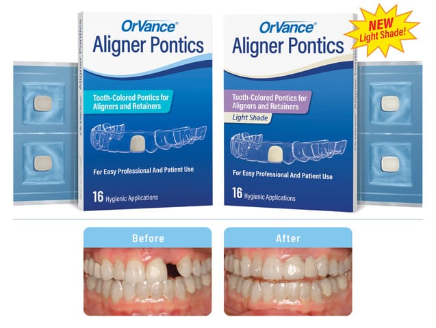 orv pntcs 16ct pkgs ms ls blstrs with ba 2400x1809px 02sep2025