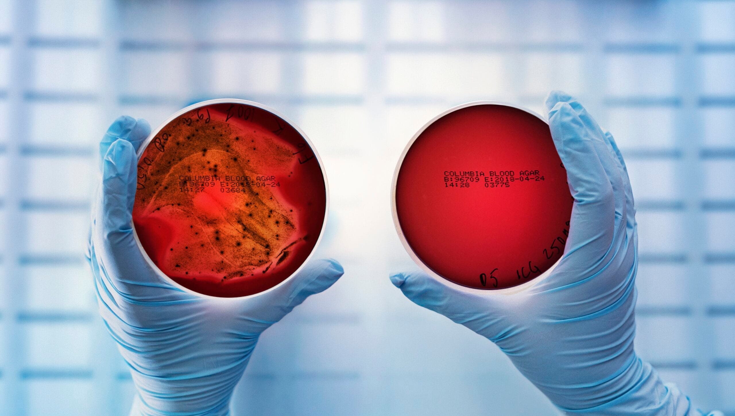 p. gingivalis untreated vs. lumoral treated